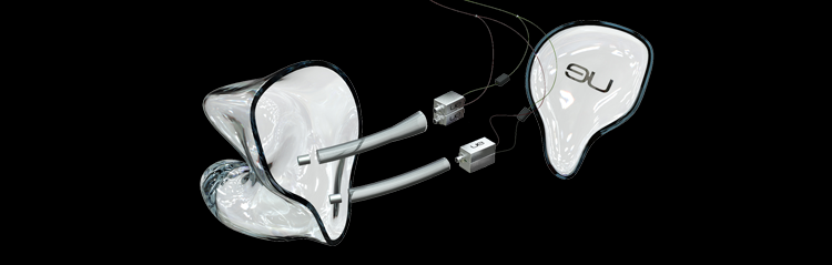 UE 1 Exploded View