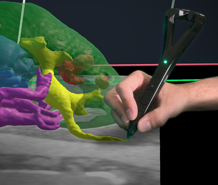 Miniature de témoignage Logitech VR Ink Pilot Edition Realize Medical